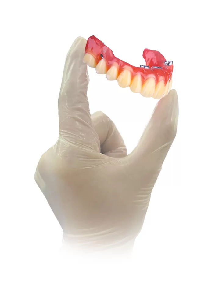 Prótesis dental impresa en 3D con la Edge mini de RAYSHAPE